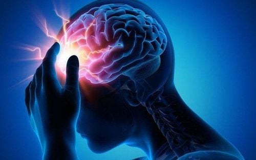 
Đột quỵ và tai biến được chia ra làm một số dạng khác nhau
