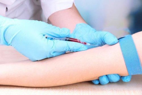 
Xét nghiệm kali máu được thực hiện khi người bệnh có dấu hiệu tăng hoặc giảm kali
