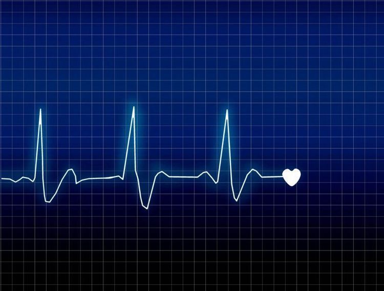 
Nhịp tim nhanh là một trong nhũng biểu hiện của nhiễm trùng máu
