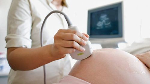 
Siêu âm thai không gây đau đớn và giúp mẹ bầu thấy được hình ảnh thai nhi
