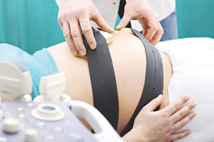 Các cơn co xuất hiện khoảng 2 cơn co trong 10 phút
