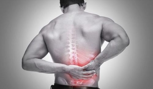 
Đau lưng là một triệu chứng của hội chứng rễ thần kinh
