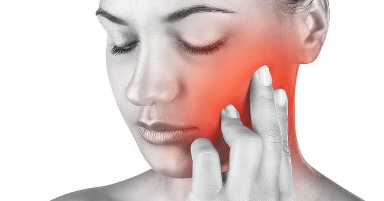
Chẩn đoán đau thần kinh V nguyên phát chủ yếu dựa vào lâm sàng
