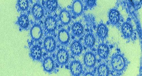 
Hình ảnh virus cúm A gây bệnh ở người

