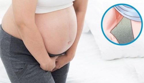 
Trẻ sơ sinh bị nhiễm trùng ối có thể do mẹ bị vỡ ối sớm trên 12 tiếng trước sinh
