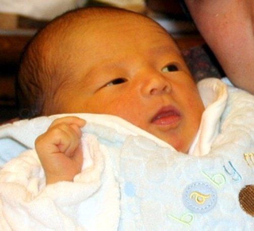 
Cha mẹ nên để ý dấu hiệu bệnh lý vàng da của trẻ
