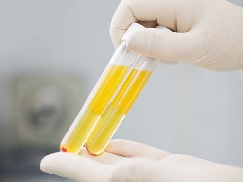 
Xét nghiệm phân hoặc huyết thanh để tìm kiếm và chẩn đoán các loại ký sinh trùng gây bệnh
