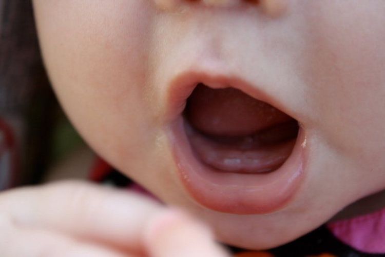 
Cần làm gì khi phát hiện con mọc răng chậm?
