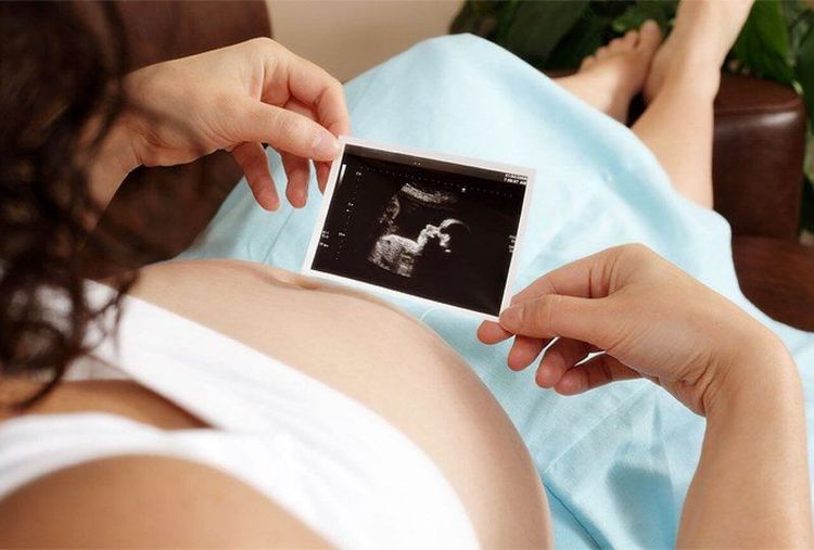
Những bất thường phổ biến nhất được phát hiện trong mặt phẳng mặt phẳng xuyên tiểu não là dị tật Dandy-Walker, dị tật Chiari II và loạn sinh hoại tử tiểu não
