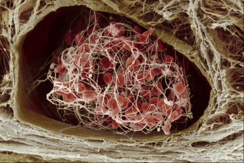 Người bệnh rối loạn đông máu thuộc nhóm đối tượng chống chỉ định