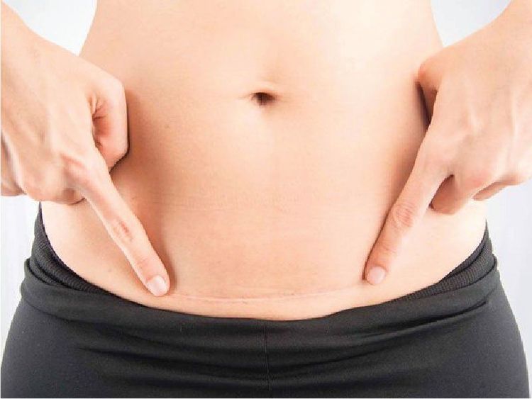 
Sinh mổ lần 3 khi đặt vòng cần có sự chỉ định của bác sĩ

