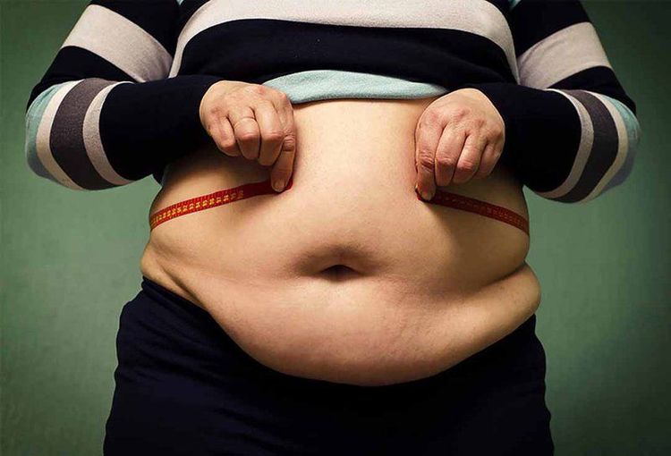 
Béo phì cũng là một yếu tố nguy cơ của ung thư tuyến tụy
