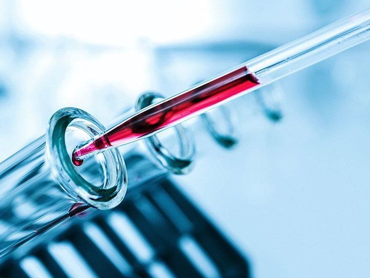 
Xét nghiệm máu giúp chẩn đoán bệnh
