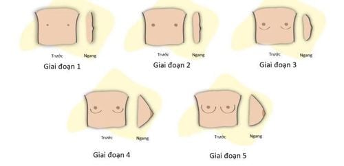 
Các giai đoạn phát triển ngực ở nữ giới
