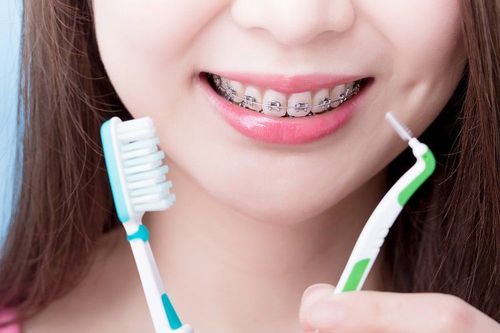 
Dùng bàn chải kẽ để chăm sóc sau niềng răng
