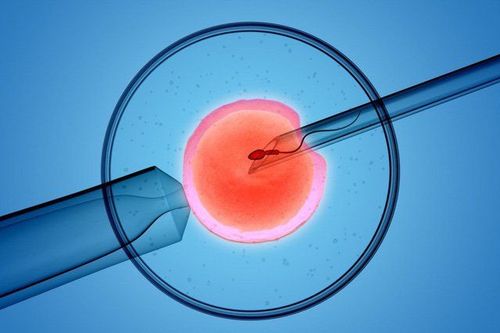 Thụ tinh trong ống nghiệm (IVF) là phương pháp hỗ trợ sinh sản được sử dụng phổ biến để giúp phụ nữ mắc lạc nội mạc tử cung có cơ hội mang thai cao hơn. 