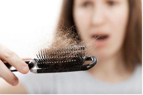 
Người bị suy giáp thường dễ gãy rụng tóc
