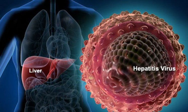 
Virus gây viêm gan mãn tính B hoặc C có thể gây ra tình trạng cổ trướng
