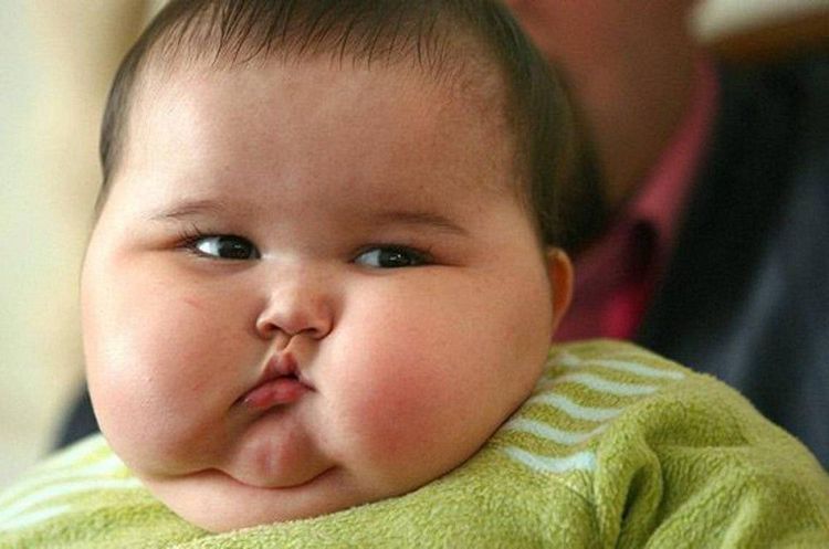 
Trẻ em mắc bệnh vẩy nến có thể mắc bệnh béo phì
