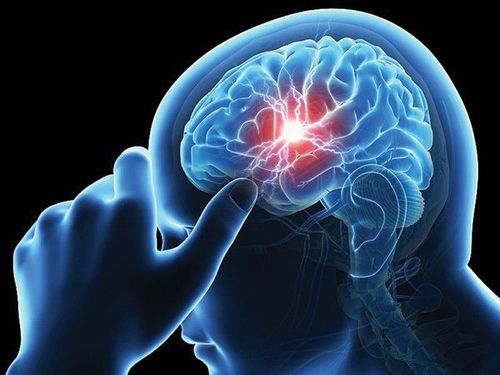
Các khối u khi xuất hiện ở não sẽ gây ra những biến chứng nguy hiểm
