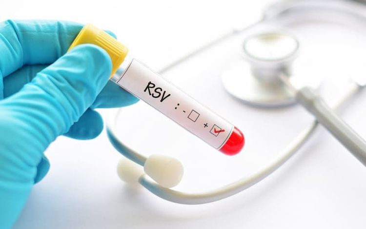 Xét nghiệm RSV