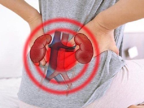 
Cơn đau quặn thận xảy ra do sỏi vào niệu quản gây bít tắc đường tiểu
