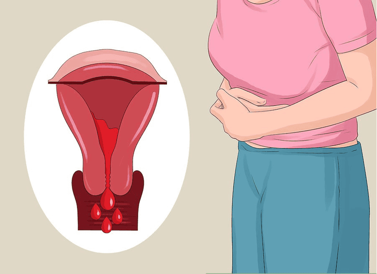 
Niêm mạc tử cung sẽ bong ra gần hết ở giai đoạn sau rụng trứng
