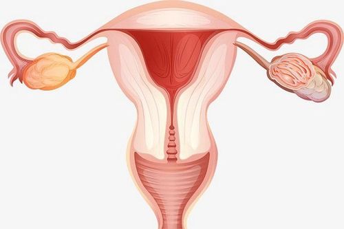
Đặt vòng có thể gây thủng tử cung sau khi hết hạn
