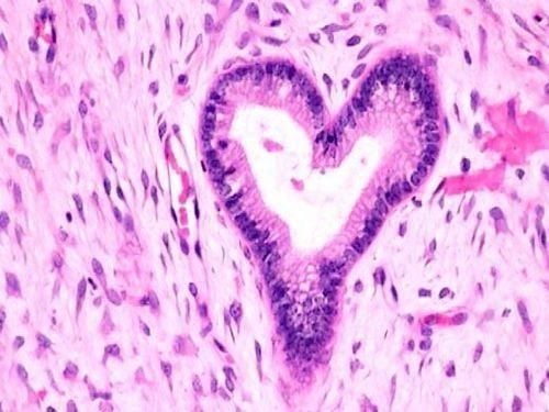 Xét nghiệm hóa mô miễn dịch