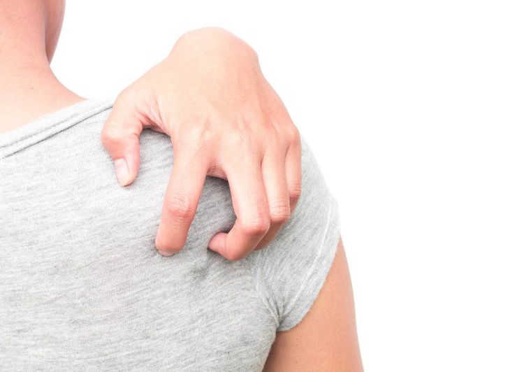 
Ghẻ, nấm da là một trong số bệnh truyền nhiễm do virus gây ra
