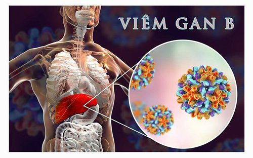 
Viêm gan tự miễn có thể được chẩn đoán nhầm với viêm gan B
