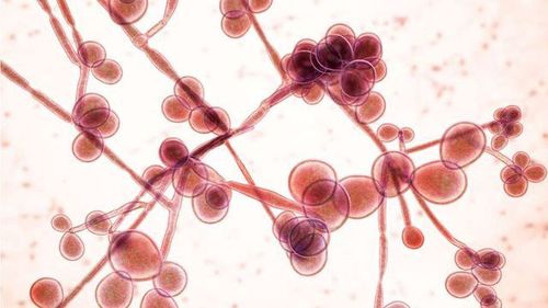 
Viêm âm đạo do nấm Candida albicans là một trong số loại viêm âm đạo phổ biến
