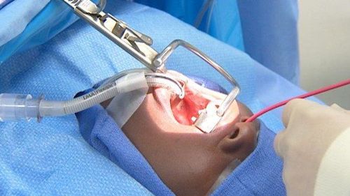
Vẫn có thể xảy ra biến chứng nhiễm trùng sau cắt amidan.
