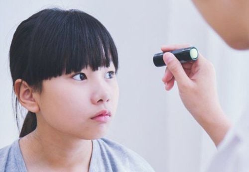 
Mắt lé ở trẻ em đang trong giai đoạn phát triển thị giác có thể gây mất thị lực
