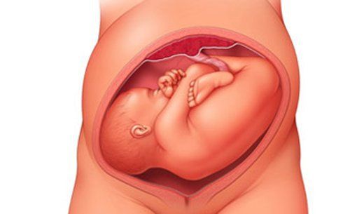 
Tử cung có thể gây ra chứng vẹo cột sống ở trẻ sơ sinh
