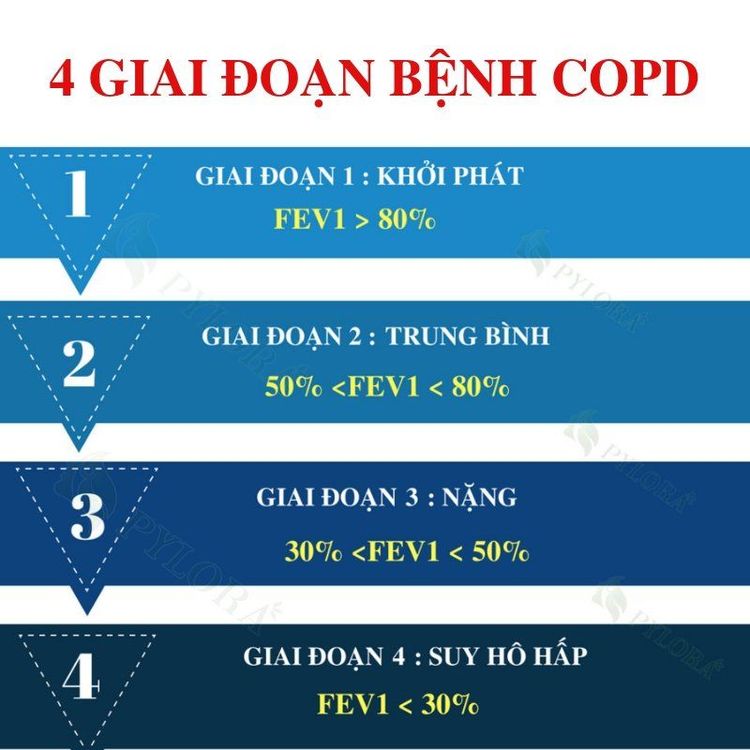 
Các giai đoạn phát triển của copd
