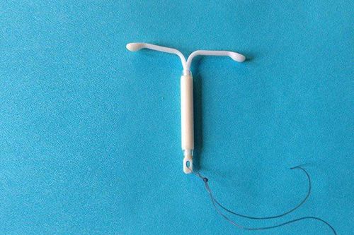 
Dụng cụ tử cung được nhiều phụ nữ tin tưởng sử dụng
