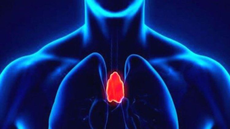 
U tuyến ức gây nhược cơ là khối u thuộc vùng trung thất.
