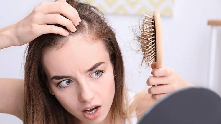 
Rụng tóc có hoặc không kèm vảy da là dấu hiệu của nấm đầu (Tinea capitis)
