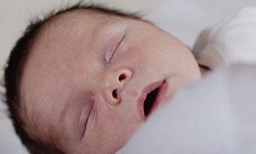 
Trẻ bị mềm sụn thanh quản đa phần sẽ hết sau 18-24 tháng tuổi
