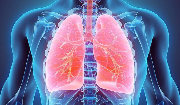 
Viêm màng phổi là một trong các yếu tố chẩn đoán bệnh Lupus ban đỏ hệ thống
