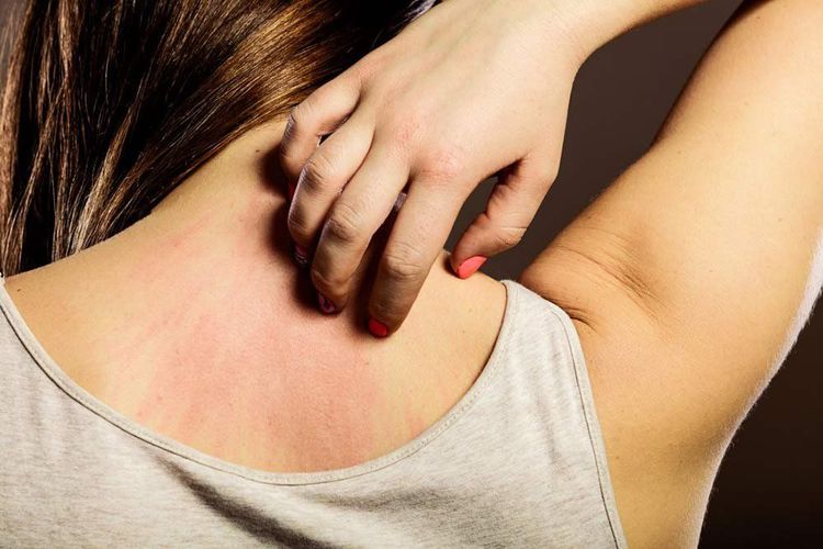 
Không nên để làn da trở nên tồi tệ mới đi khám bác sĩ
