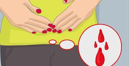 Người bệnh bị u xơ tử cung có biểu hiện đặc trưng là ra kinh nhiều bất thường 