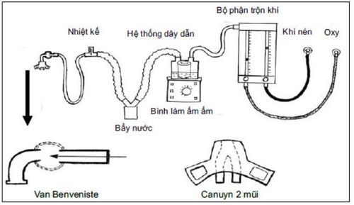 
Thở áp lực dương liên tục qua đường mũi (NCPAP) giúp duy trì một áp lực dương liên tục trong suốt chu kỳ thở
