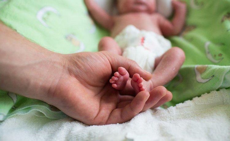 
Bệnh u nguyên bào gan có thể gặp ở trẻ sinh non nhẹ cân
