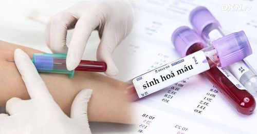 
xét nghiệm sinh hóa máu thực hiện khá thường quy
