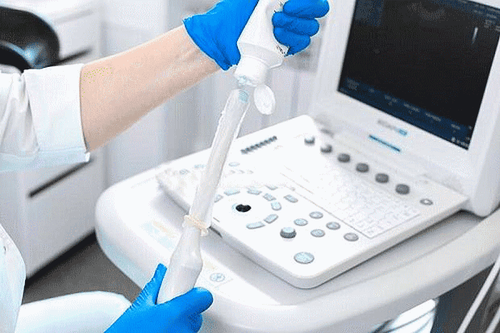 
Với phương pháp siêu âm đầu dò, chuyên gia y tế sẽ sử dụng một một dụng cụ chuyên dụng có phần đầu tròn nhỏ và tiến vào trong âm đạo để quan sát được chi tiết bên trong tử cung và buồng trứng
