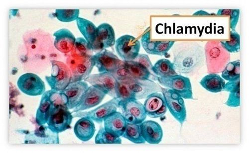 
Vi khuẩn Chlamydia
