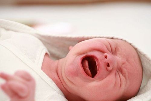 
Trẻ mệt mỏi, muốn đi ngủ có thể khiến trẻ quấy khóc
