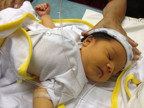 
Bệnh vàng da ở trẻ sơ sinh là căn bệnh khiến cho da và lòng trắng trong mắt trẻ có màu vàng
